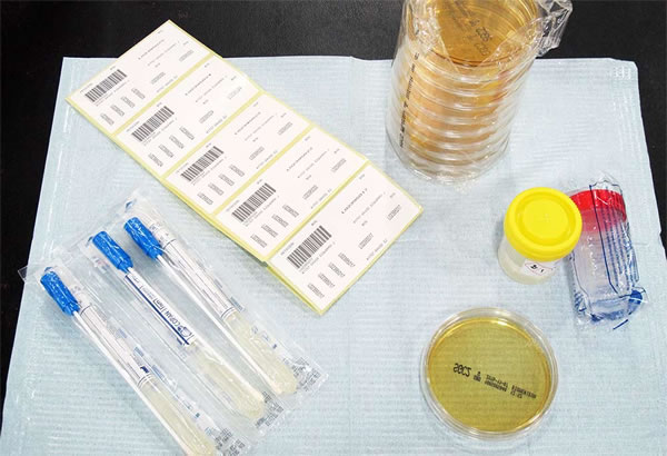 The Bacteria Science Experiment